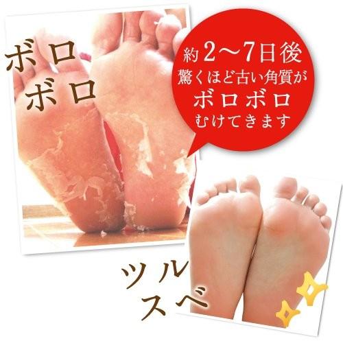 発生 クスコ 直感 足 の 裏 ベビー フット Smartcare Tachibana Jp