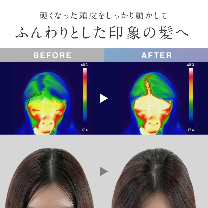 NIPLUX ヘッドスパ 頭皮マッサージ EMSヘッドマッサージ NIPLUX EMS