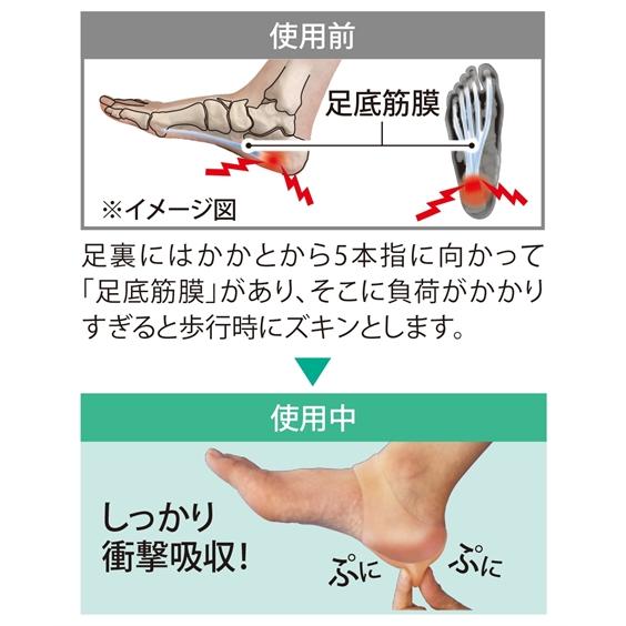 足底筋膜保護 サポーター ニッセン nissen｜nissenzai｜03