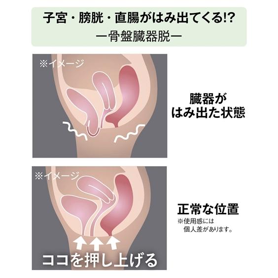健康グッズ ☆ 骨盤 臓器脱 サポーター 春 夏 秋 冬 ニッセン nissen_4