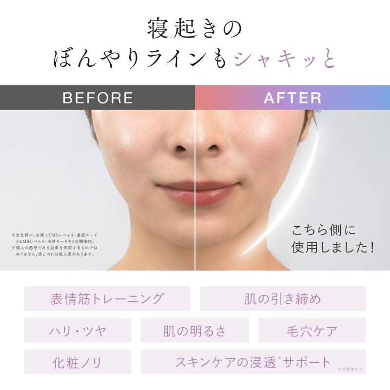 NIPLUX 電動かっさ EMS美顔器 MEGURiS メグリス フェイスケア 冷感 温