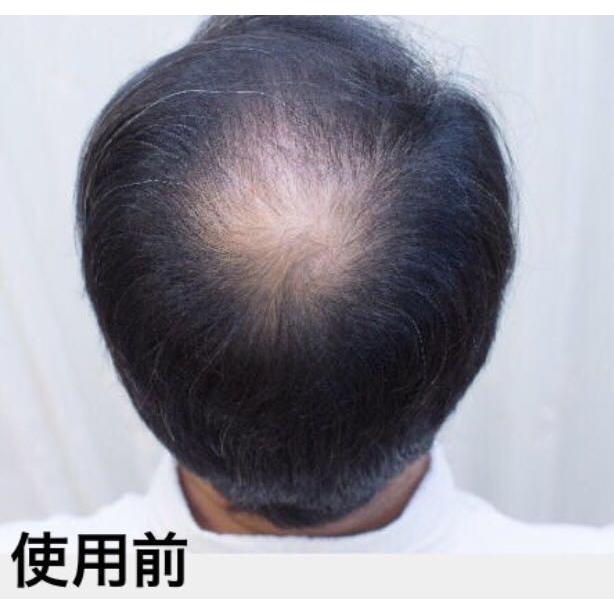増毛ふりかけヘアーファンデーション分け目白髪隠しカバー生え際かくし