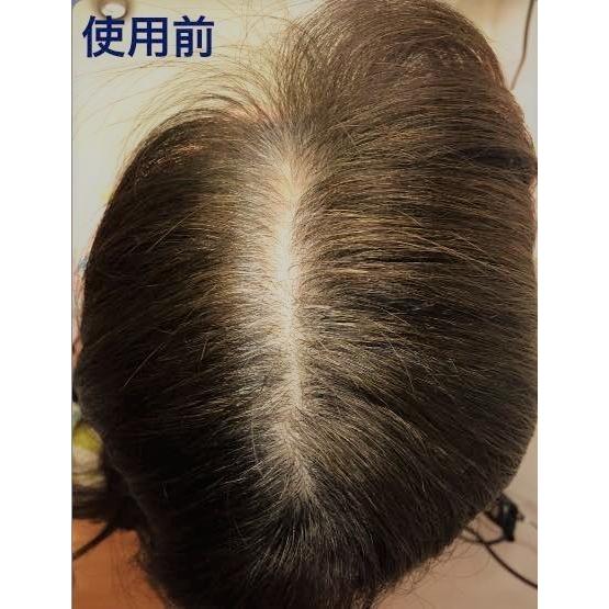 増毛ふりかけ ヘアーファンデーション詰替え 分け目白髪隠しカバー 生え際かくしカバー つむじ禿げ隠し薄毛ハゲかくし マイクロヘアーパウダー詰め替え用｜nlcc-store｜04