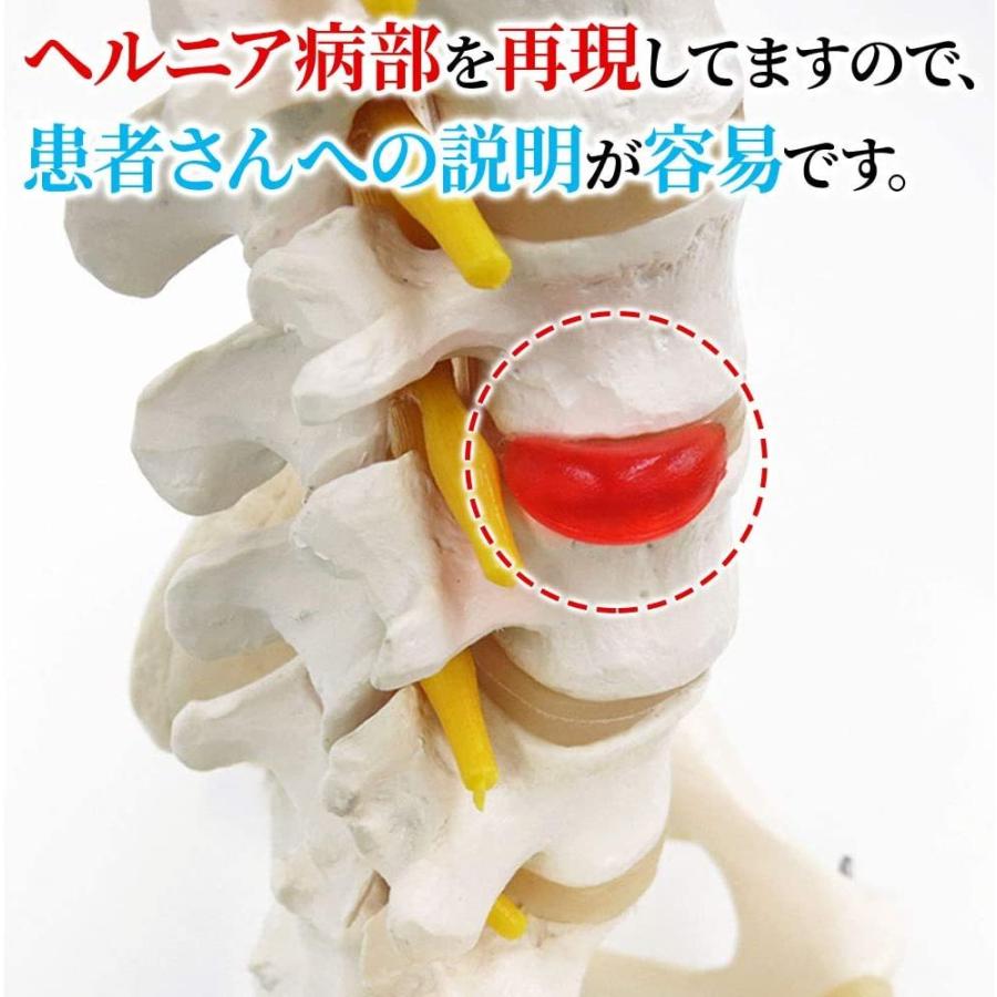 人体模型 骨 等身大 脊椎 模型 実物大 センチ 脊髄骨盤模型 股関節