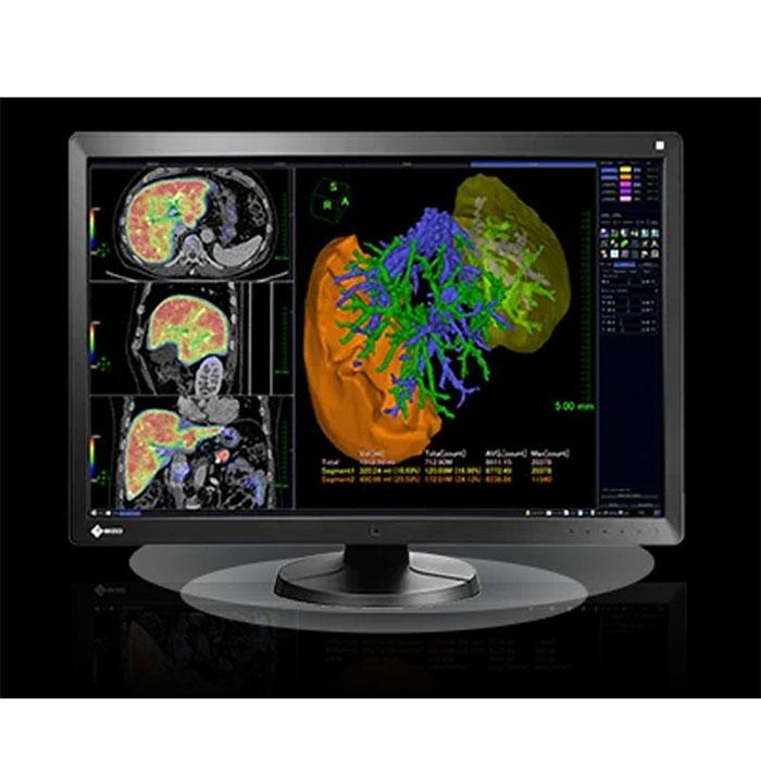 eizo-eizo-radiforce-rx650-30-6