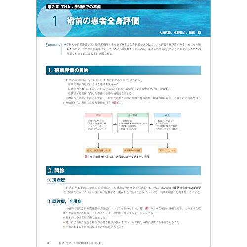 BHA・THA 人工股関節置換術パーフェクト?人工骨頭置換術・人工股関節全置換術の基本とコツ BHA THA 手術までの準備 術前計画