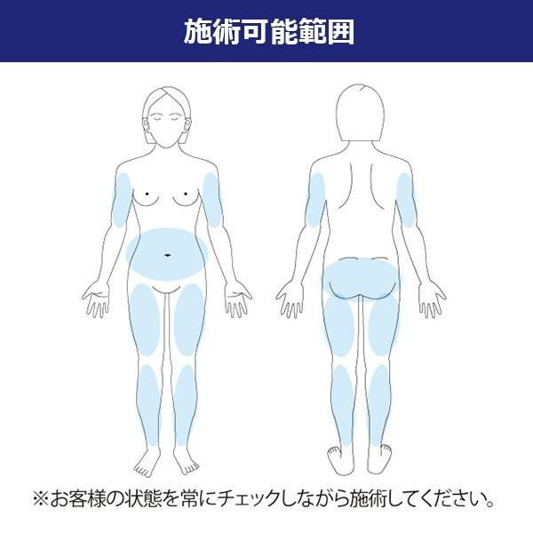 キャビテーションマシン　CC PRO-01 29345.jpg