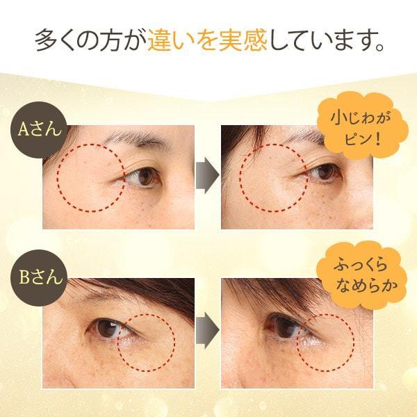 MEDISTHE（メディステ） 薬用 フェイスクリーム シワ改善 クリーム