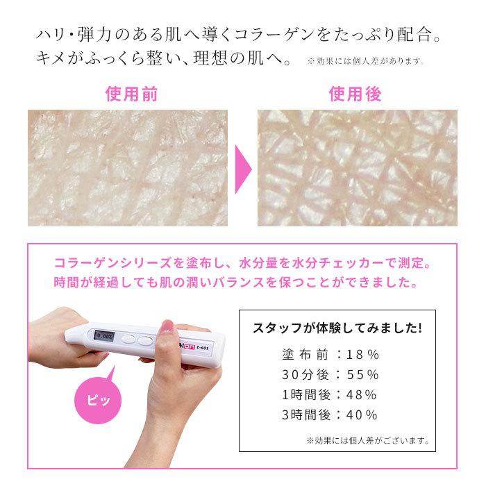 PROSBi コラーゲン 化粧水 500ml プロズビ 業務用 保湿 エステ