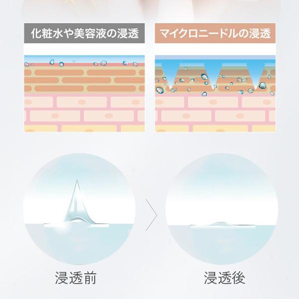 SEVEN BEAUTY（セブンビューティー） マイクロニードル ヒアルロン酸 2