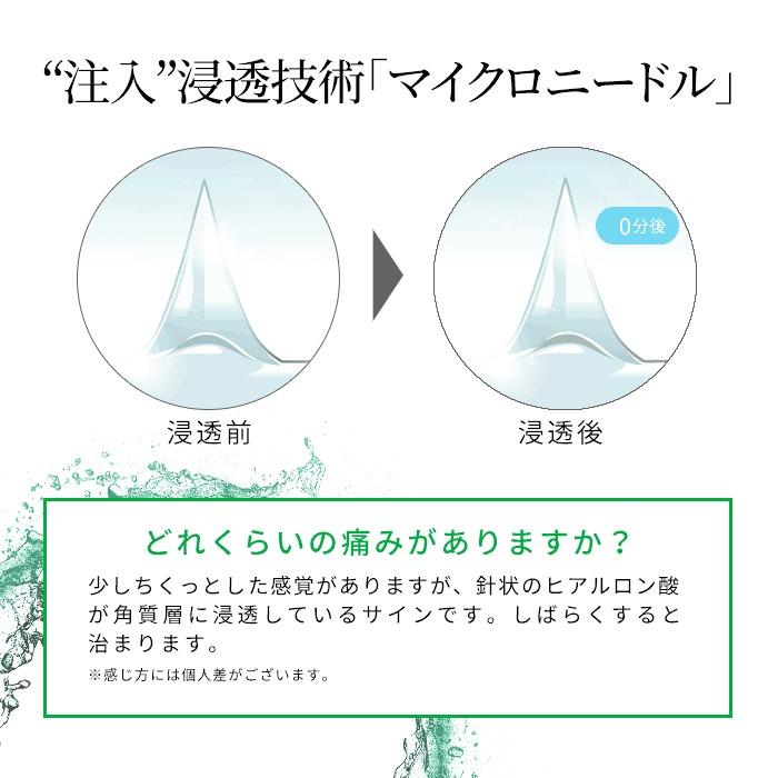 マイクロニードル CICA 2枚入 シカ パッチ 目元美容液 ほうれい線 アイ
