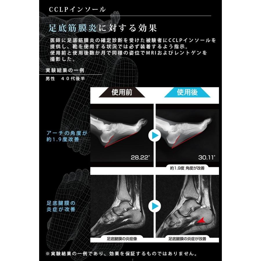 BMZ インソール メンズ レディース 中敷き カルパワー スマートフィット ビーエムゼット 高機能 スポーツ 日常生活 ゴルフ 野球｜o-kini｜08