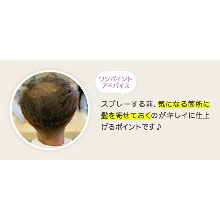 アデランス 「マイクロジェッター」 瞬間増毛 白髪隠し 薄毛カバー