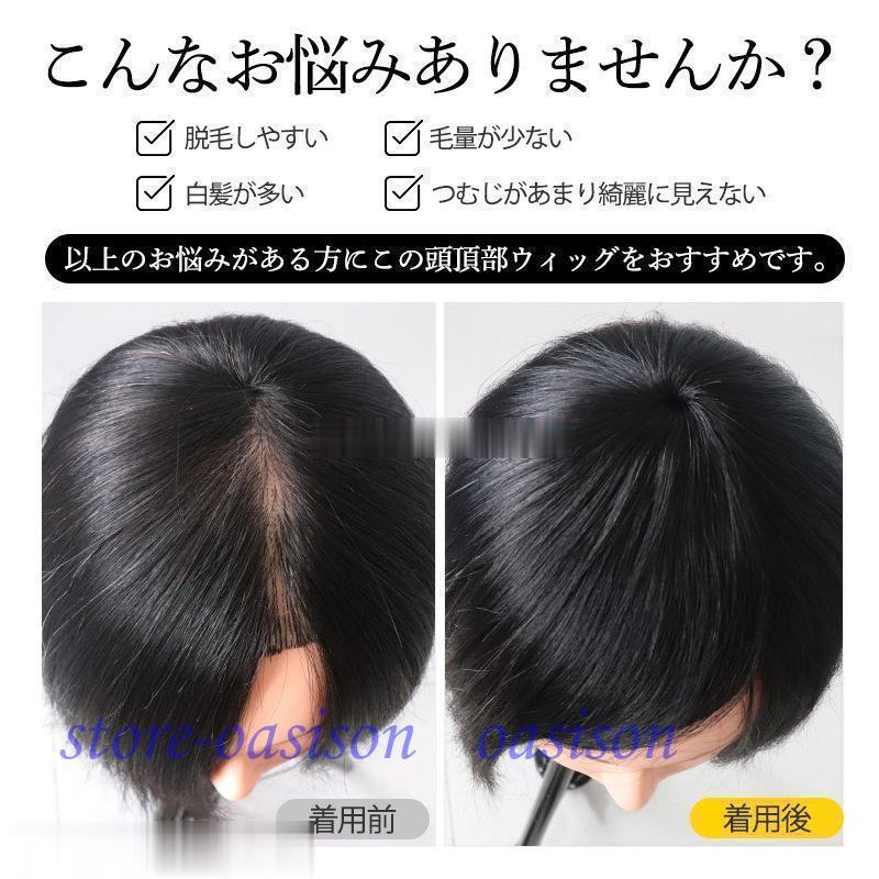 頭頂部ウィッグ レディース ショート 自然 ヘアピース 薄毛 白髪隠し
