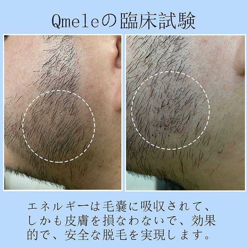 Qmele 脱毛器 冷感モード付き IPL光脱毛器 家庭用 光美容器 ンズ レディース 光エステ 全身 脱毛 脱毛器 冷感モード付き IPL光脱毛器 家庭用 光美容器 ンズ レディース 光エステ 全身 脱毛