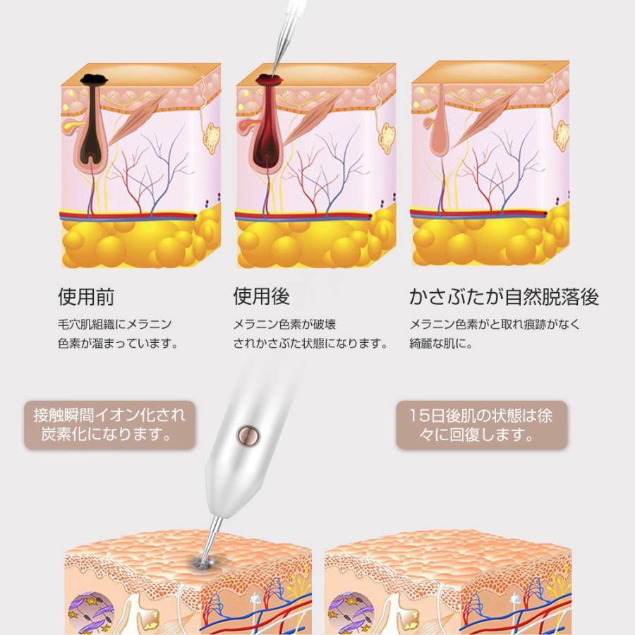 レーザーペン レーザースポットペン レーザー除去ペン 美顔器 レーザーペン レーザースポットペン レーザー除去ペン 美顔器