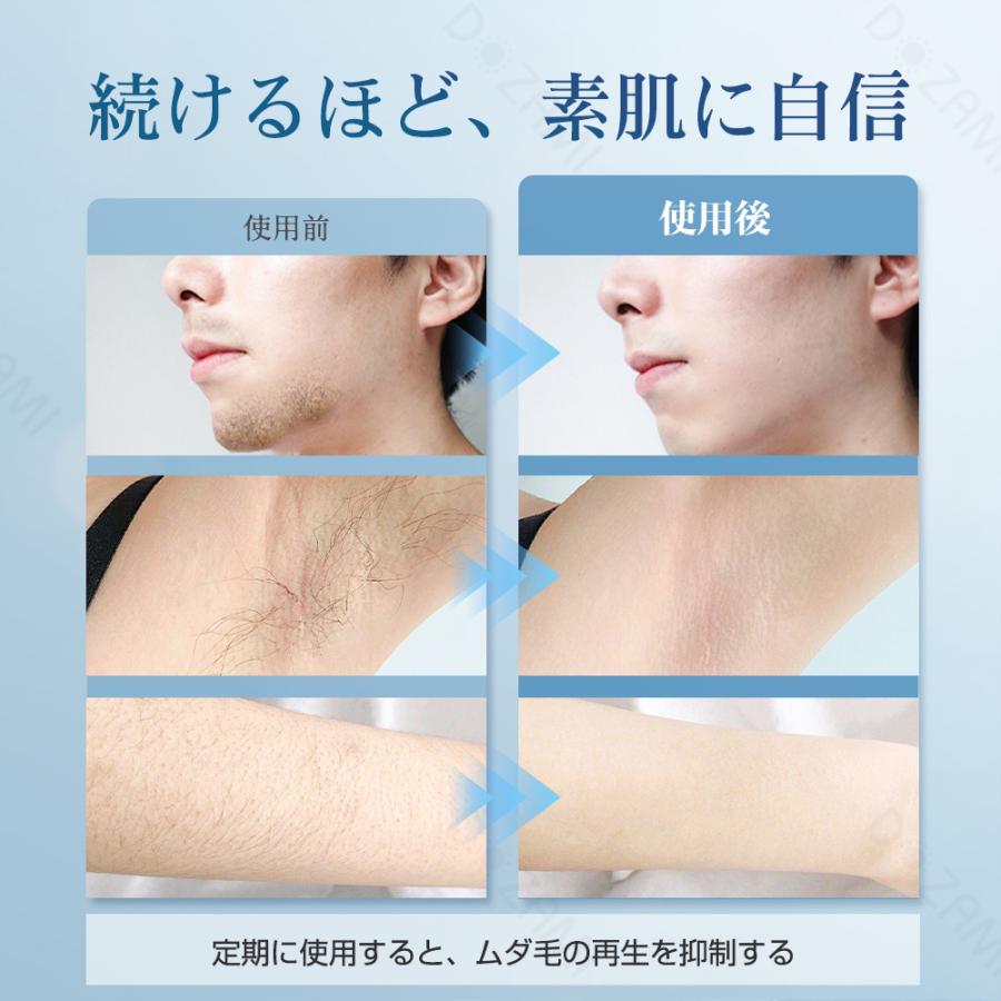 脱毛器 全身脱毛 VIO対応 だつもうき 無制限照射 メンズ 脱毛器 全身脱毛 VIO対応 だつもうき 無制限照射 メンズ