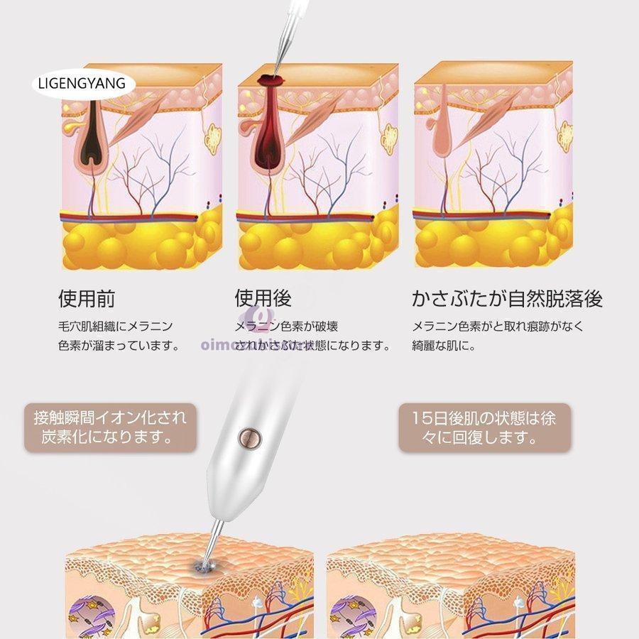 レーザーペン レーザー除去ペン 美顔器 シミ取り イボ 口コミ