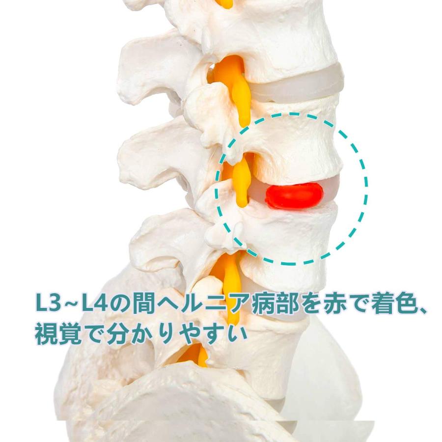 脊椎模型 85cm 脊椎骨盤模型 脊柱模型 可動式 脊髄骨盤模型 人体 脊椎模型 85cm 脊椎骨盤模型 脊柱模型 可動式 脊髄骨盤模型 人体