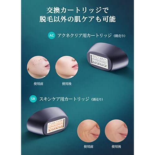 kensen 脱毛器 光美容器 光脱毛 IPL式 99万発照射 冷感脱毛 自動モード レベル5階段 光エステ メンズ 髭 家庭用 クール vio 脱毛器単品