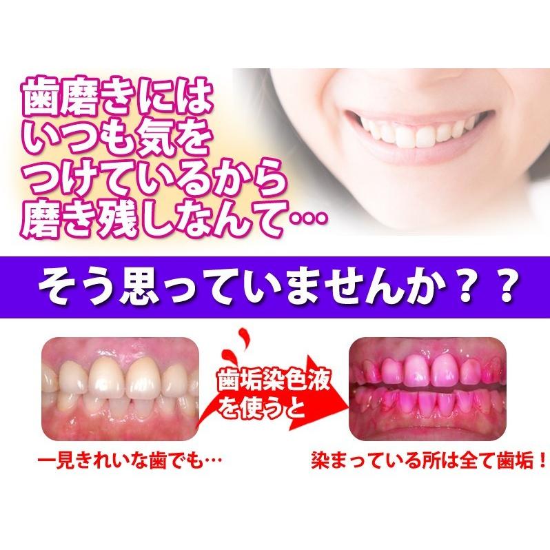 クローバー 歯垢染め出し液 5ml :A-00001810:お口の専門店 - 通販 - Yahoo!ショッピング クローバー 歯垢染め出し液 5ml :A-00001810:お口の専門店 - 通販 - Yahoo!ショッピング