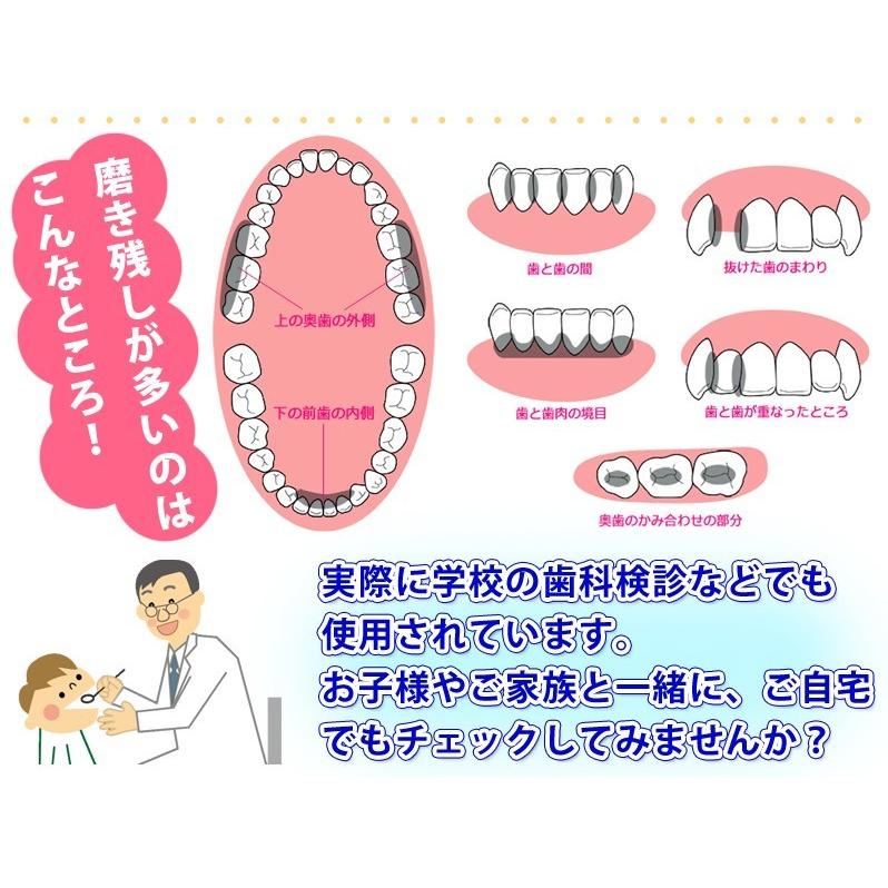 クローバー 歯垢染め出し液 5ml :A-00001810:お口の専門店 - 通販 - Yahoo!ショッピング クローバー 歯垢染め出し液 5ml :A-00001810:お口の専門店 - 通販 - Yahoo!ショッピング