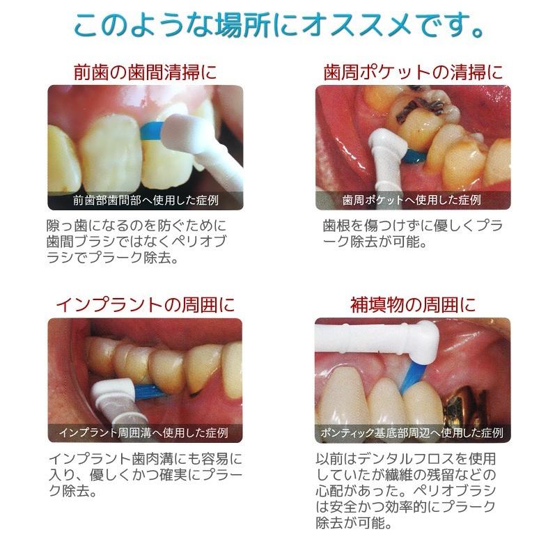 ジーシー ルシェロ ペリオブラシ 替ブラシ NO.1T NO.2T(10個入) メール便送料無料｜okuchi｜04