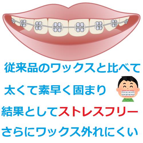 V Pro V-Pro 歯列矯正 矯正治療の効率を高める補助的装置 VPro+ について - 【公式