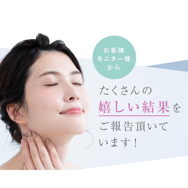 表情筋 トレーニング 顔痩せ リフトアップ 小顔 美顔器 フェイス