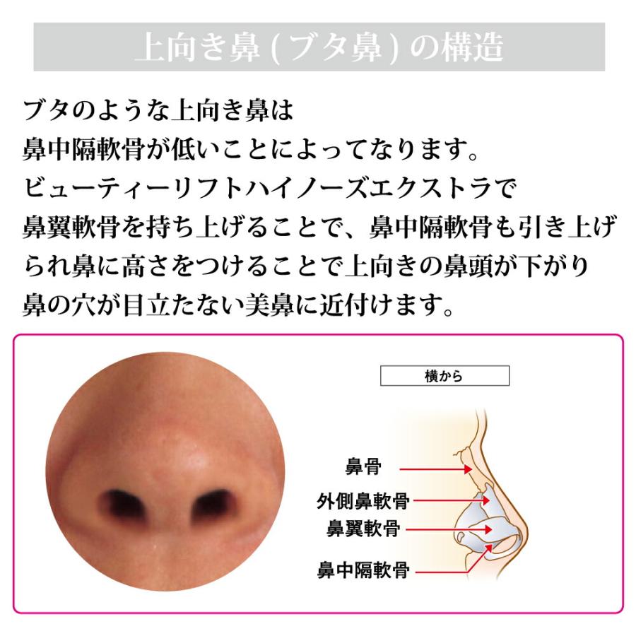 美鼻矯正器具 鼻 矯正 高く 鼻プチ 美鼻 リフトアップ 鼻筋 団子鼻 わし鼻 : OMNI ONLINE STORE - 通販 ...