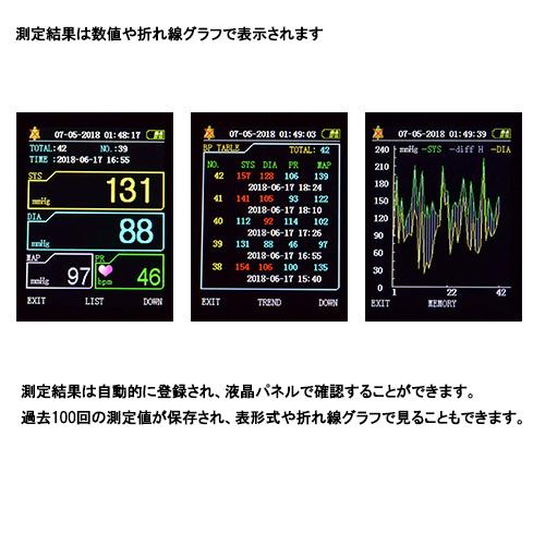 エルデ ペット用血圧計 犬 猫 PES-1700 : オムニストア - 通販 - Yahoo