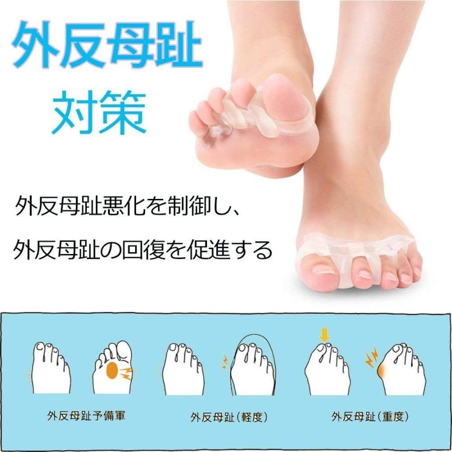 足 指 広げる パッド 浮き指 内反小趾 矯正 健康グッズ Sukwii フットケア 足 指 セパレーター 足のゆび ひろげる シリコン製 ショップオモテナシ 通販 Yahoo ショッピング