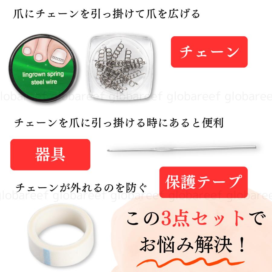 巻き爪 矯正 陥入爪 ケア 調整 セルフケア 数量限定 特別価格 チェーン