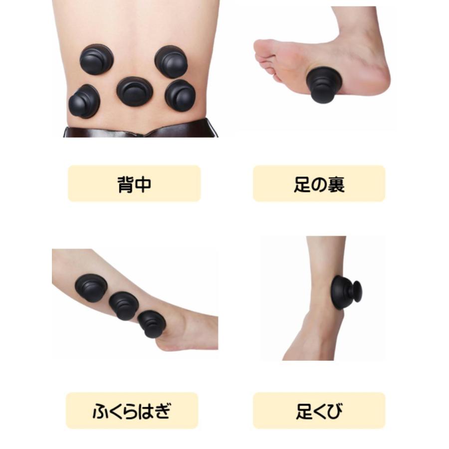 TAKUBOTA カッピング シリコンカッピング 吸い玉 ポータブル ソフトヘルスカッピング ブラック 8個セット CAPI-001 |  | 03