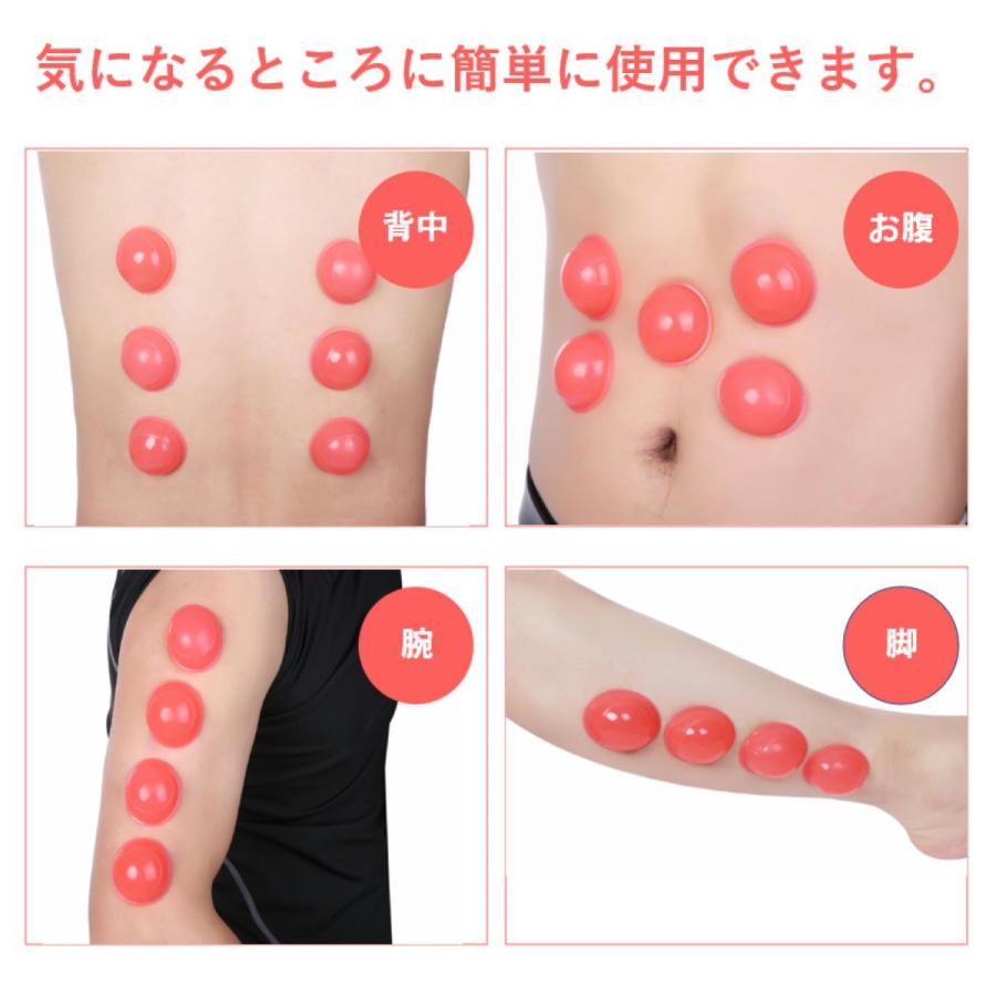 TAKUBOTA カッピング 押すだけ 簡単 シリコンカッピング 吸い玉 10個セット CAPI-002 |  | 01