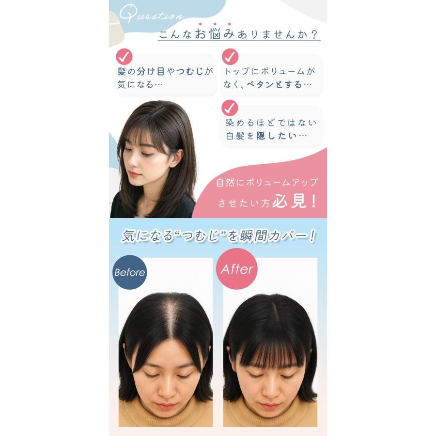 トップピース　つむじ分け目ピース ウィッグ 女性 前髪 つむじ 3点クリップ 分け目カバー トップカバー