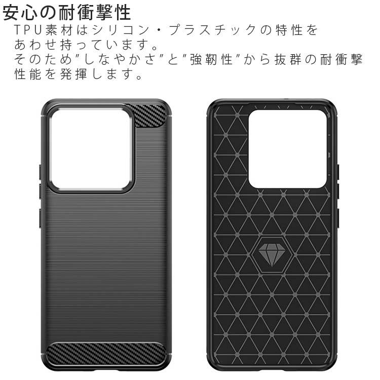 Xiaomi 14T Pro ケース xiaomi14tpro カーボン調 薄型 耐衝撃 ソフト