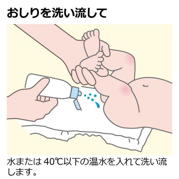 リッチェル 赤ちゃんおしりシャワーr 激安正規
