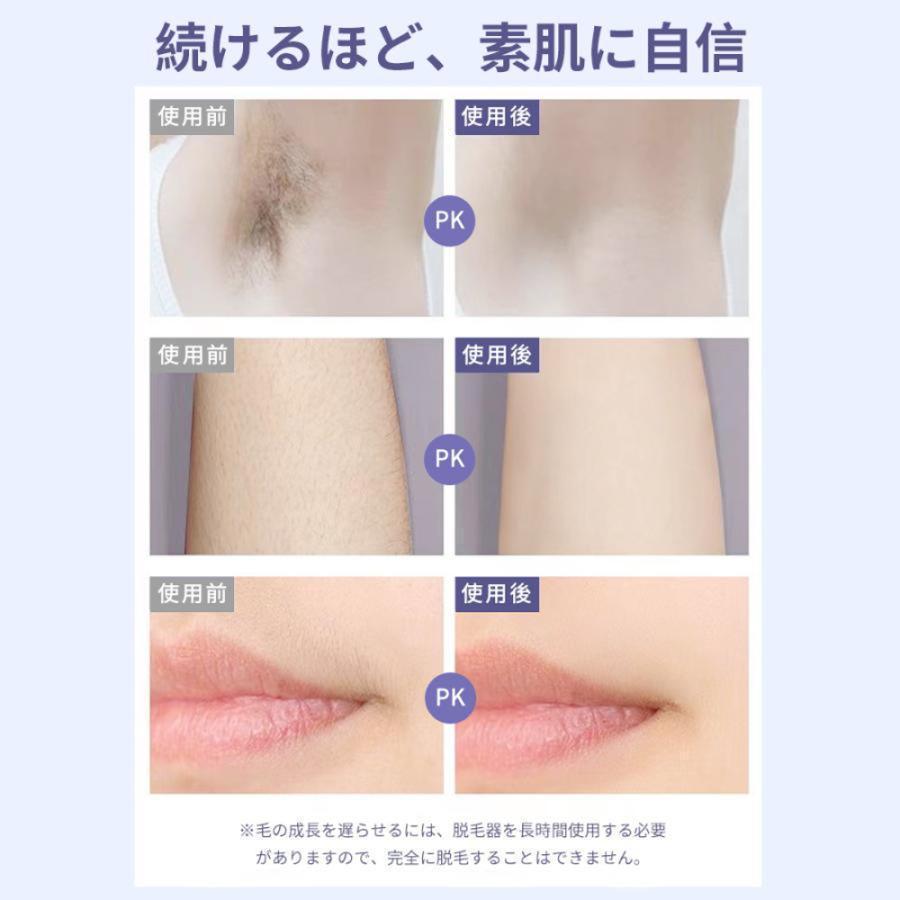 脱毛器 vio対応 男女兼用 家庭用脱毛器 無痛 美肌 手 全身用 顔 脱毛器 vio対応 男女兼用 家庭用脱毛器 無痛 美肌 手 全身用 顔
