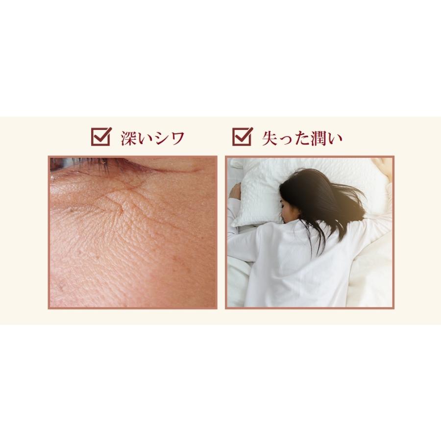 MC-14 別冊宝島　６４０　美肌スキンケア　５　シミ　シワ　たるみ MC-14 別冊宝島 640 美肌スキンケア 5 シミ シワ たるみ