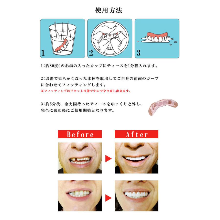 インスタントスマイルコンフォート薄型 繰り返し使えるワンタッチ付け歯 仮歯 入れ歯 付け歯 義歯 歯並び |  | 03