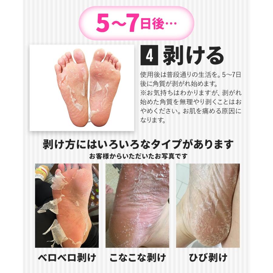 足裏 角質除去 ペロリン 4回分 かかと 角質ケア パック ひび割れ 乾燥 足の角質取り かかとケア フットケア 履くだけ フットピーリングパック|otbj|13