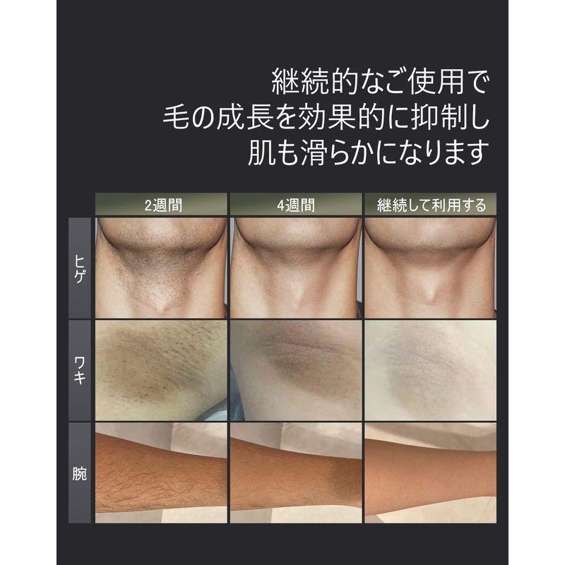 商品追加値下げ在庫復活MEGELIN 脱毛器 メンズ レディース サファイア