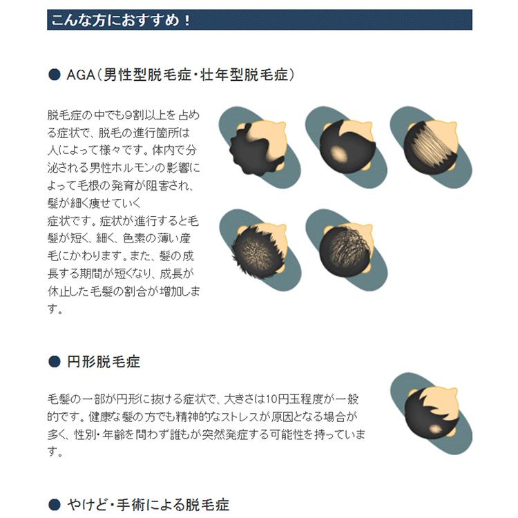 スーパーミリオンヘアー トライアルセット No 1ブラック 10g 専用