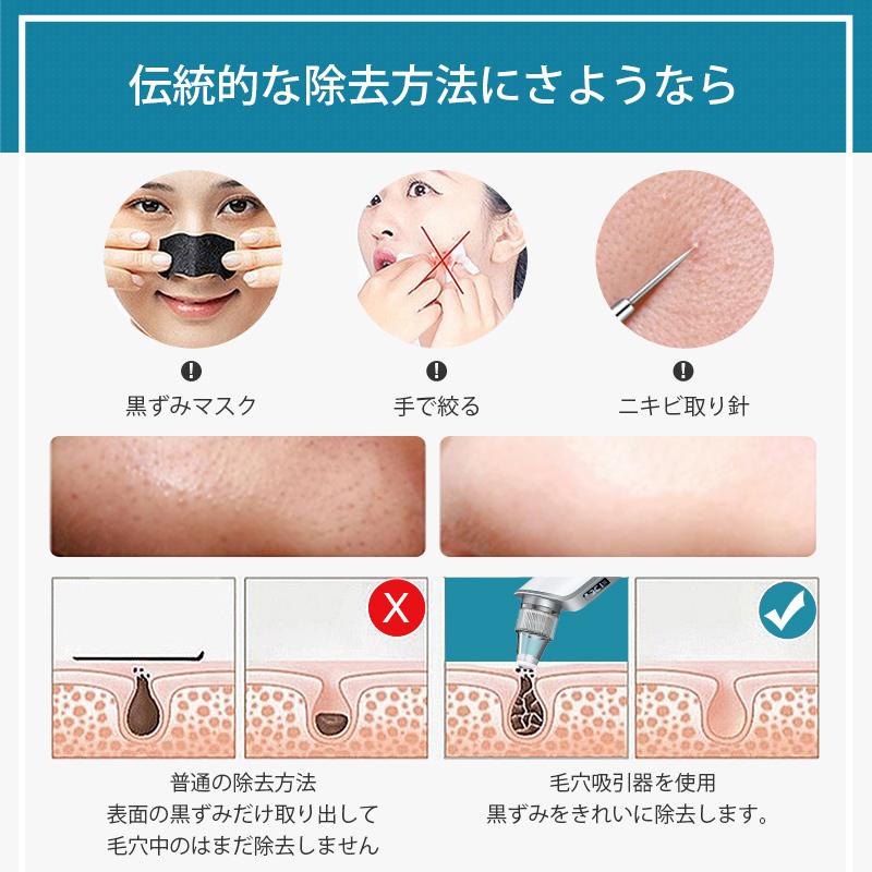 毛穴吸引器 黒ずみ 美顔器 角栓 除去 吸引 毛穴クリーン 毛穴クリーナー 毛穴 ケア美顔器 Lcdディスプレイ搭載 Usb充電 プレゼント 男女兼用 B1kkshtb お得館 通販 Yahoo ショッピング