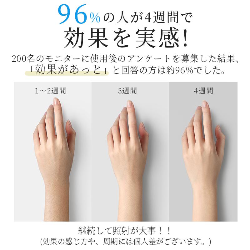 脱毛器 vio対応 21Jパワー 全身快速脱毛 サロン級HIPL& 脱毛器 vio対応 21Jパワー 全身快速脱毛 サロン級HIPL&