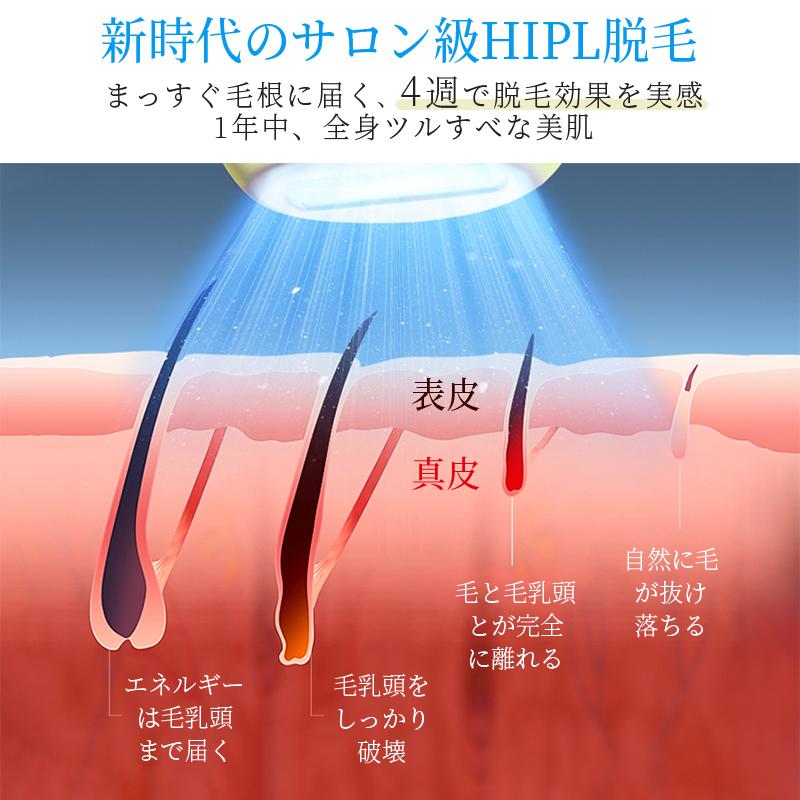 脱毛器 vio対応 21Jパワー サロン級HIPL&サファイア氷感 5段階 脱毛器 vio対応 21Jパワー サロン級HIPL&サファイア氷感 5段階