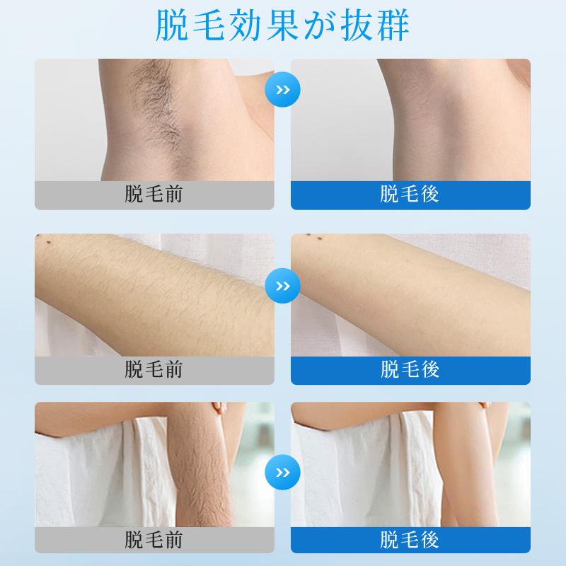 脱毛器 vio対応 21Jパワー サロン級HIPL&サファイア氷感 5段階 脱毛器 vio対応 21Jパワー サロン級HIPL&サファイア氷感 5段階