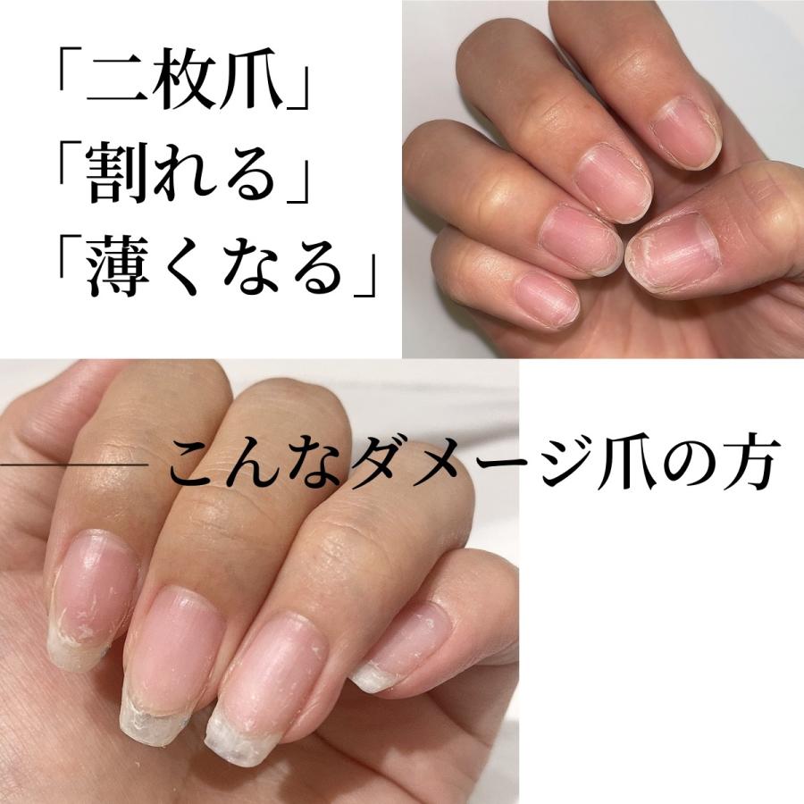 市場 期間限定クーポン配布中 セラムベースコート ジェルブレイク 3点セット Opi 宅配送料無料 プロテクタートップコート ネイルラッカー