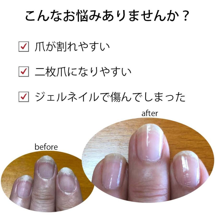 宅配送料無料 爪割れ防止ケアセット Opi最強トリオ ネイルケア ネイルエンビー キューティクルオイル アセトンフリー リムーバーオーピーアイ マニュアル付 Tumeware Set3 マニキュア通販 大人ネイル 通販 Yahoo ショッピング